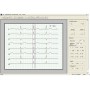 48h Holter EKG se záznamníkem a softwarem