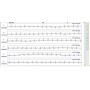48h ECG Holter with recorder and software