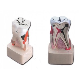 Model de patologie dentară