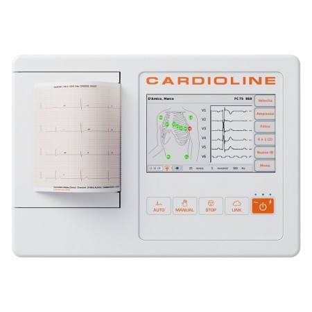 Dotykový elektrokardiograf CARDIOLINE ECG100L + počítačový softvér EasyAPP + interpretácia údajov z Glasgowu