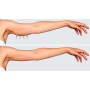 Ultrasuoni per la bellezza UltraSonicWaves Beauty dotazione VISO e CORPO