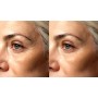Ultrasuoni per la bellezza UltraSonicWaves Beauty dotazione VISO e CORPO